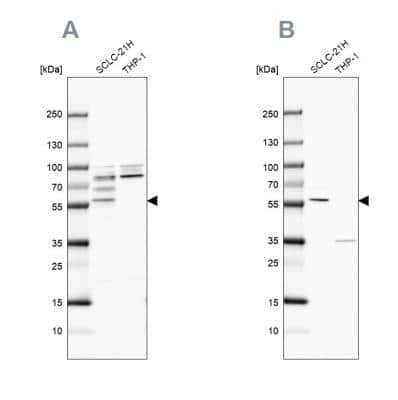 Western Blot: RIPX Antibody [NBP1-89614]