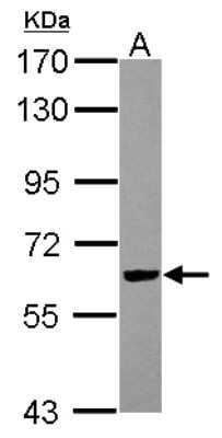 Western Blot: RIPX Antibody [NBP2-20168]