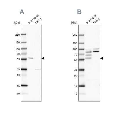 Western Blot: RIPX Antibody [NBP2-48558]