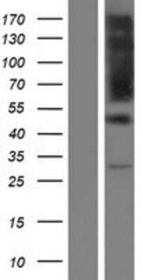 Western Blot: RIPX Overexpression Lysate [NBP2-10301]