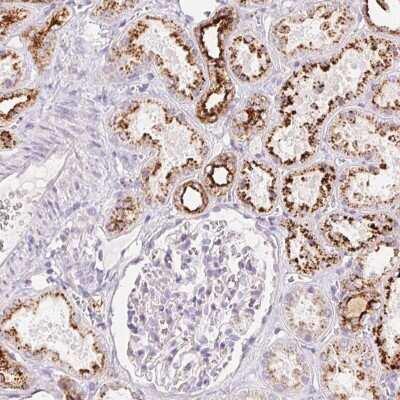 Immunohistochemistry: RISC Antibody [NBP2-49250]