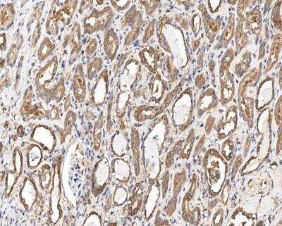 Immunohistochemistry-Paraffin: RISC Antibody [NBP3-12560]