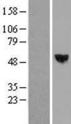 Western Blot: RISC Overexpression Lysate [NBL1-15750]