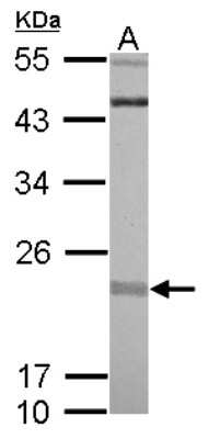 Western Blot: Rit1 Antibody [NBP2-20169]