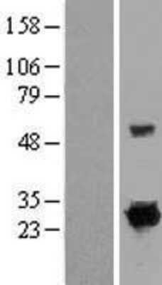 Western Blot: Rit1 Overexpression Lysate [NBP2-07557]