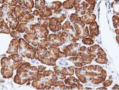 Immunohistochemistry-Paraffin: Rit2 Antibody (OTI3F4) [NBP2-03062]