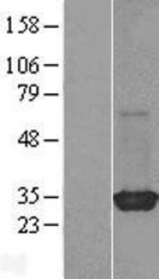 Western Blot: Rit2 Overexpression Lysate [NBL1-15382]