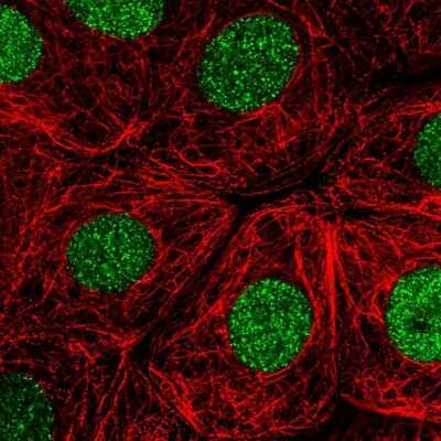 Immunocytochemistry/ Immunofluorescence: RITA Antibody [NBP2-56524]