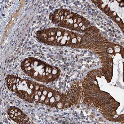 Immunohistochemistry: RITA Antibody [NBP1-94003]