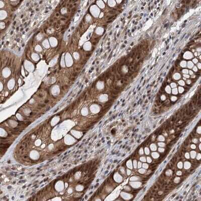 Immunohistochemistry-Paraffin: RITA Antibody [NBP2-38441]