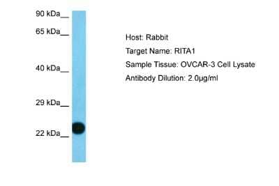 Western Blot: RITA Antibody [NBP2-88156]