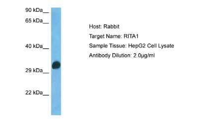 Western Blot: RITA Antibody [NBP2-88157]