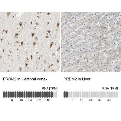 Immunohistochemistry-Paraffin: RIZ1 Antibody [NBP1-89644]