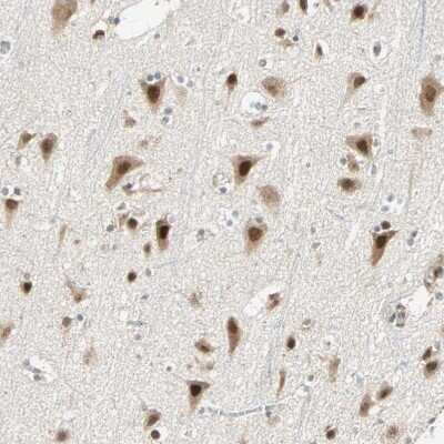 Immunohistochemistry-Paraffin: RIZ1 Antibody [NBP1-89644]