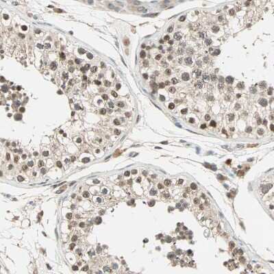 Immunohistochemistry-Paraffin: RIZ1 Antibody [NBP1-89644]