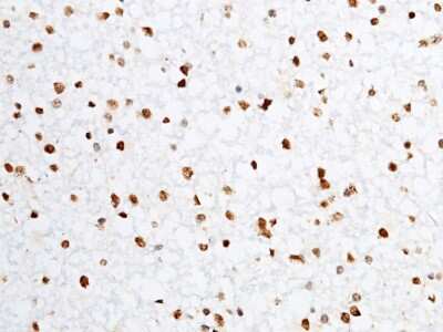 Immunohistochemistry-Paraffin: RIZ1 Antibody [NBP2-99748]