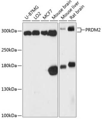 Western Blot: RIZ1 AntibodyAzide and BSA Free [NBP2-94500]