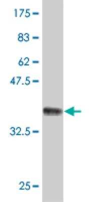 Western Blot: RKHD3 Antibody (4C4) [H00084206-M05]