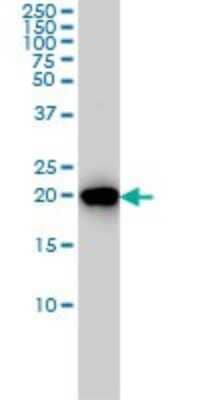 Western Blot: RKIP/PBP Antibody (1D3-1B6) [H00005037-M02]