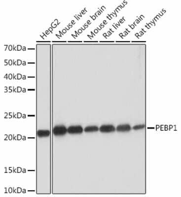 Western Blot: RKIP/PBP Antibody (1X2G1) [NBP3-15455]