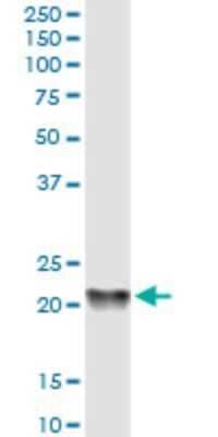 Western Blot: RKIP/PBP Antibody (2G2-1F1) [H00005037-M01]