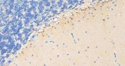 Immunohistochemistry-Paraffin: RKIP/PBP Antibody [NB100-1020]