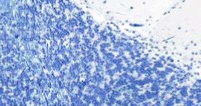 Immunohistochemistry-Paraffin: RKIP/PBP Antibody [NB100-1020]