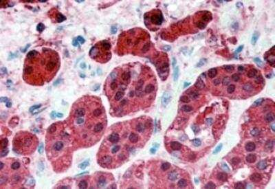 Immunohistochemistry-Paraffin: RKIP/PBP Antibody [NB100-53808]