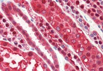 Immunohistochemistry-Paraffin: RKIP/PBP Antibody [NB100-53808]