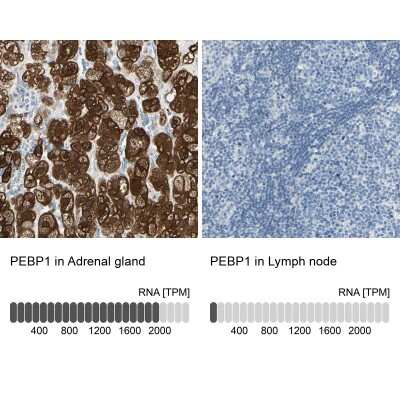 Immunohistochemistry-Paraffin: RKIP/PBP Antibody [NBP1-89711]