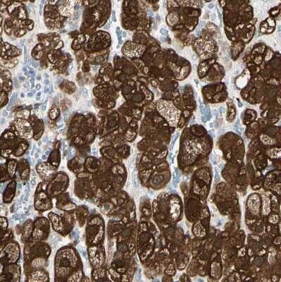 Immunohistochemistry-Paraffin: RKIP/PBP Antibody [NBP1-89711]