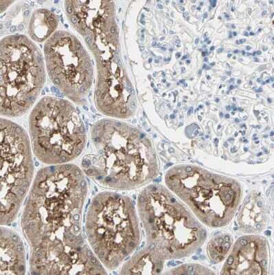 Immunohistochemistry-Paraffin: RKIP/PBP Antibody [NBP1-89711]