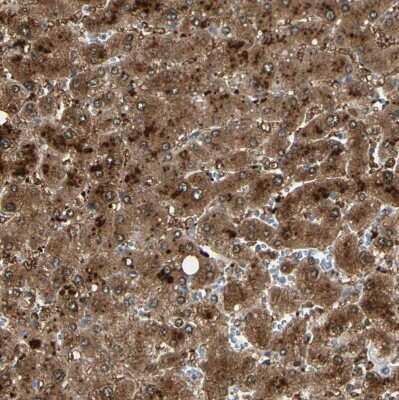 Immunohistochemistry-Paraffin: RKIP/PBP Antibody [NBP1-89711]