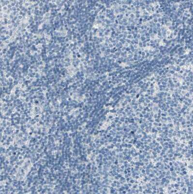 Immunohistochemistry-Paraffin: RKIP/PBP Antibody [NBP1-89711]