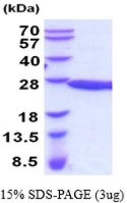 SDS-PAGE: Recombinant Mouse RKIP/PBP His Protein [NBP2-52174]