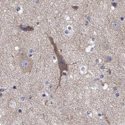 Immunohistochemistry-Paraffin: RLBP1L1 Antibody [NBP3-17925]