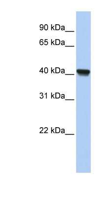 Western Blot: RLBP1L1 Antibody [NBP1-55291]