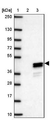 Western Blot: RLBP1L1 Antibody [NBP2-47508]