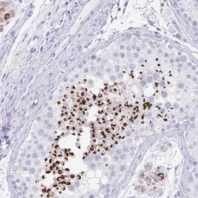 Immunohistochemistry-Paraffin: RLF Antibody [NBP2-33827]