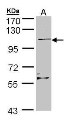 Western Blot: RLF Antibody [NBP1-33086]