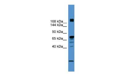 Western Blot: RLF Antibody [NBP3-10493]