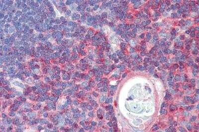 Immunohistochemistry-Paraffin: RLK/TXK Antibody [NBP1-37000]