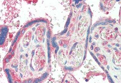 Immunohistochemistry-Paraffin: RLK/TXK Antibody [NBP1-37000]