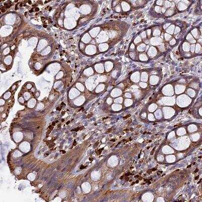 Immunohistochemistry: RLTPR Antibody [NBP1-91220]