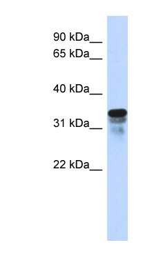 Western Blot: RMD1 Antibody [NBP1-57839]