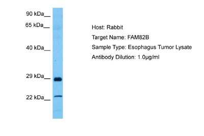 Western Blot: RMD1 Antibody [NBP2-85641]