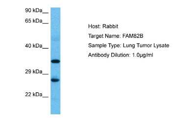 Western Blot: RMD1 Antibody [NBP2-85642]