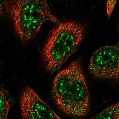 Immunocytochemistry/ Immunofluorescence: RMI2 Antibody [NBP1-89962]