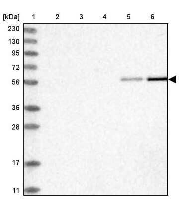 Western Blot: RMND1 Antibody [NBP1-90033]