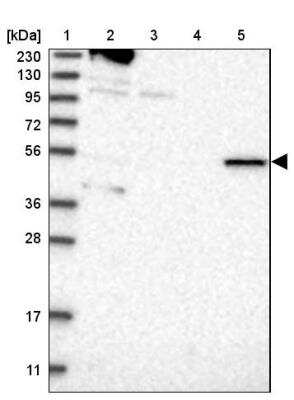 Western Blot: RMND1 Antibody [NBP2-33952]